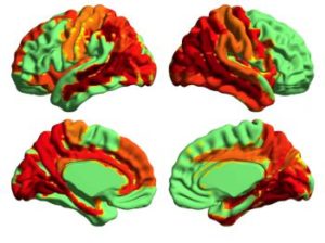 actividad cerebral